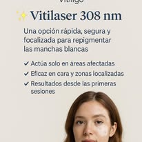 Vitilaser 308 nm